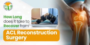 Read more about the article How Long Does It Take to Recover from ACL Reconstruction Surgery?