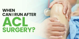 Read more about the article When Can I Run After ACL Surgery?