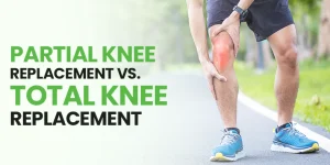 Read more about the article Partial Knee Replacement  vs. Total Knee Replacement: Understanding Your Options