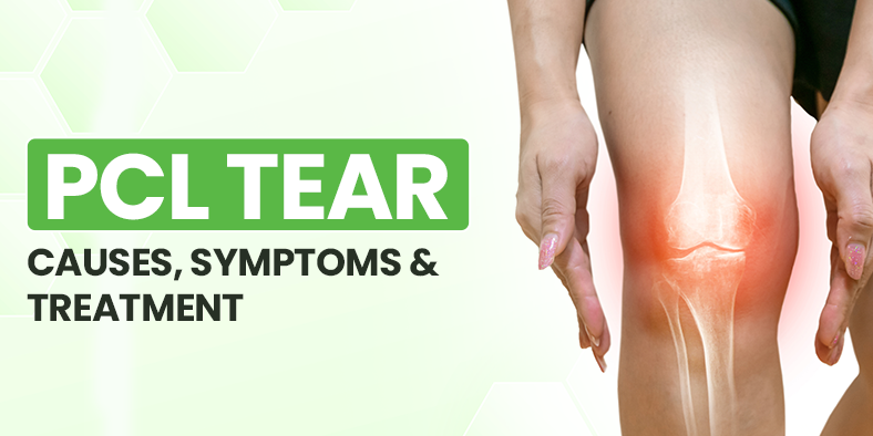 Read more about the article PCL Tear: Causes, Symptoms, & Treatment